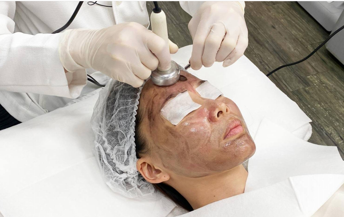 吃甜食.含糖飲料皮膚易出油…醫曝最新雷射科技！長青春痘免再吃藥